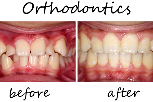 Orthodontics1
