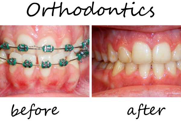 Orthodontics3